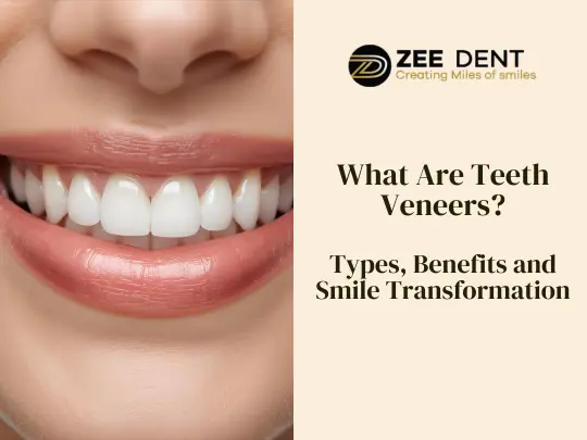 What Are Teeth Veneers Types, Benefits and Who Should Get Them