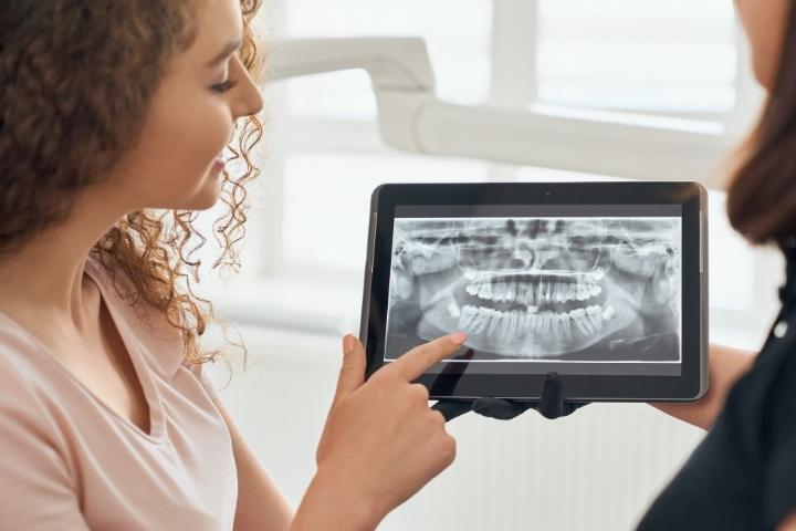 3D Guided Implant Surgery