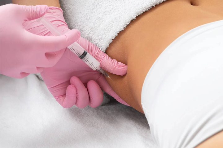 Fat Injections