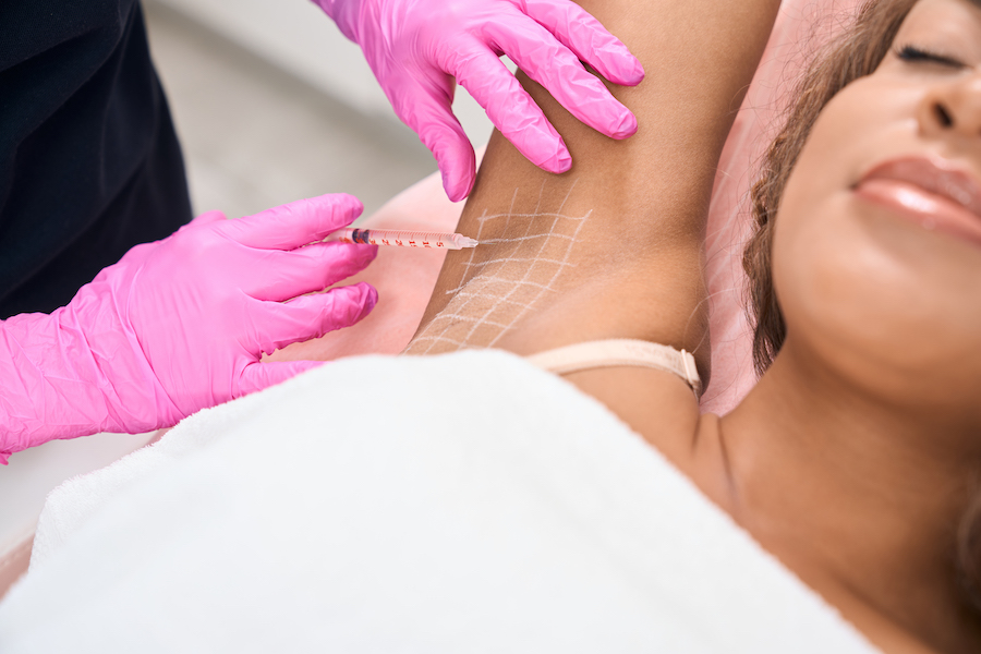 Hyperhidrosis Treatment in Dubai