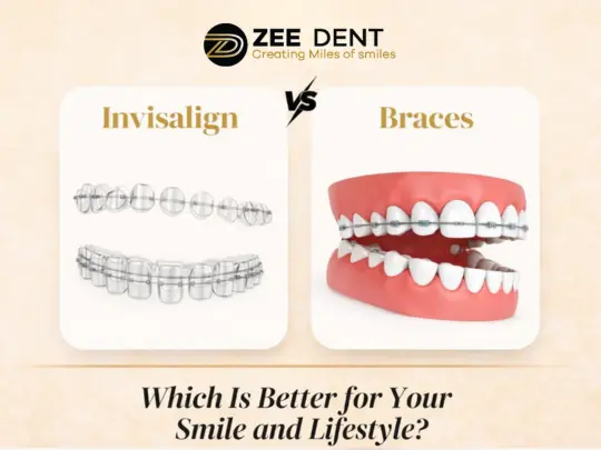 Invisalign vs Braces Which Is Better for Your Smile and Lifestyle