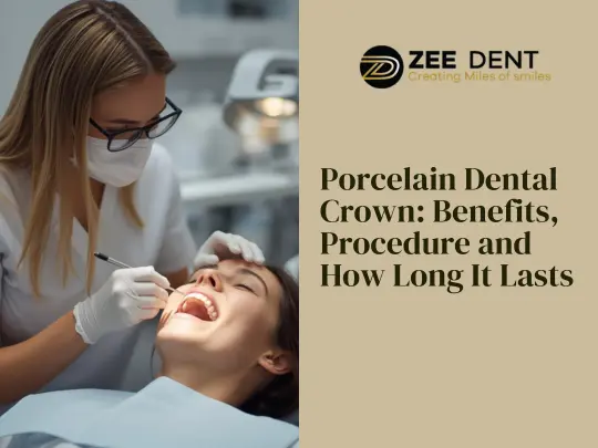 Porcelain Dental Crown Benefits, Procedure and How Long It Lasts