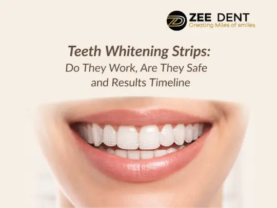 Teeth Whitening Strips Do They Work, Are They Safe and Results Timeline
