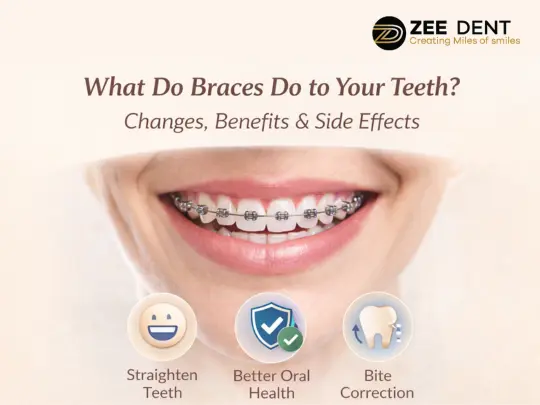What Do Braces Do to Your Teeth Changes, Benefits & Side Effects
